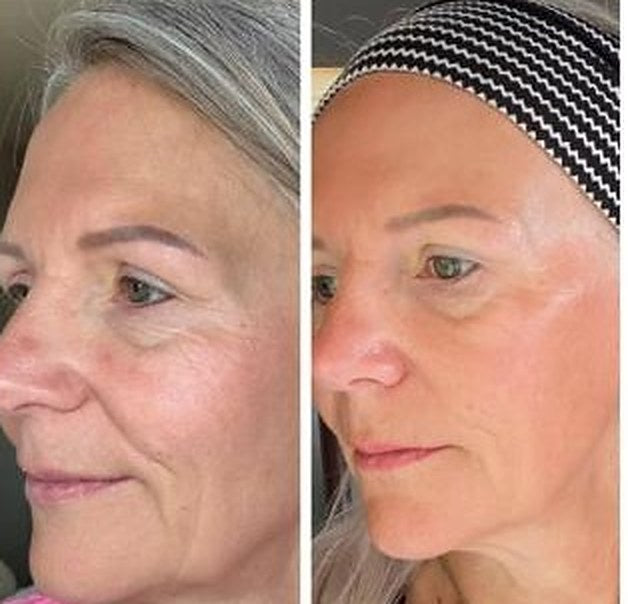 Before and after