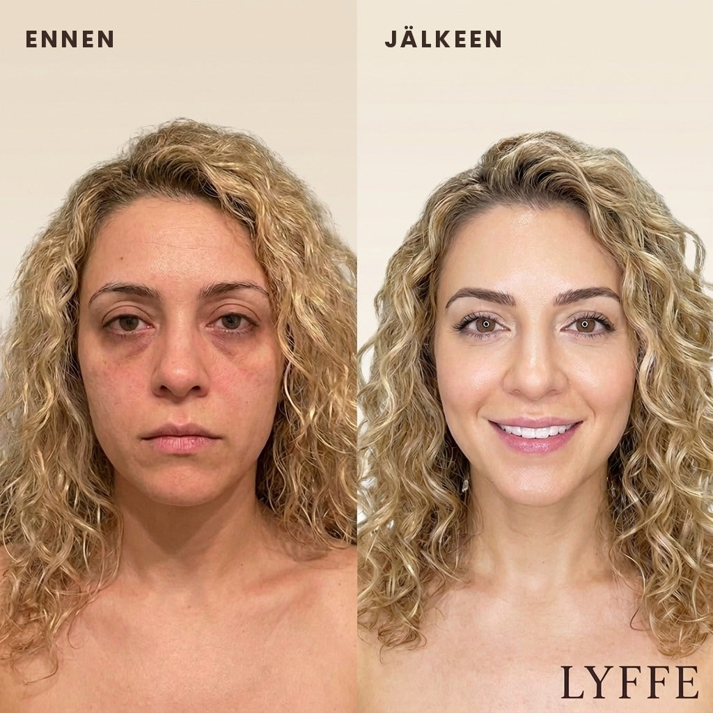 Ennen ja jälkeen